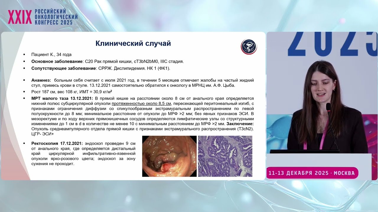 Клинический случай: Тотальная неоадъювантная терапия при раке среднеампулярного отдела прямой кишки