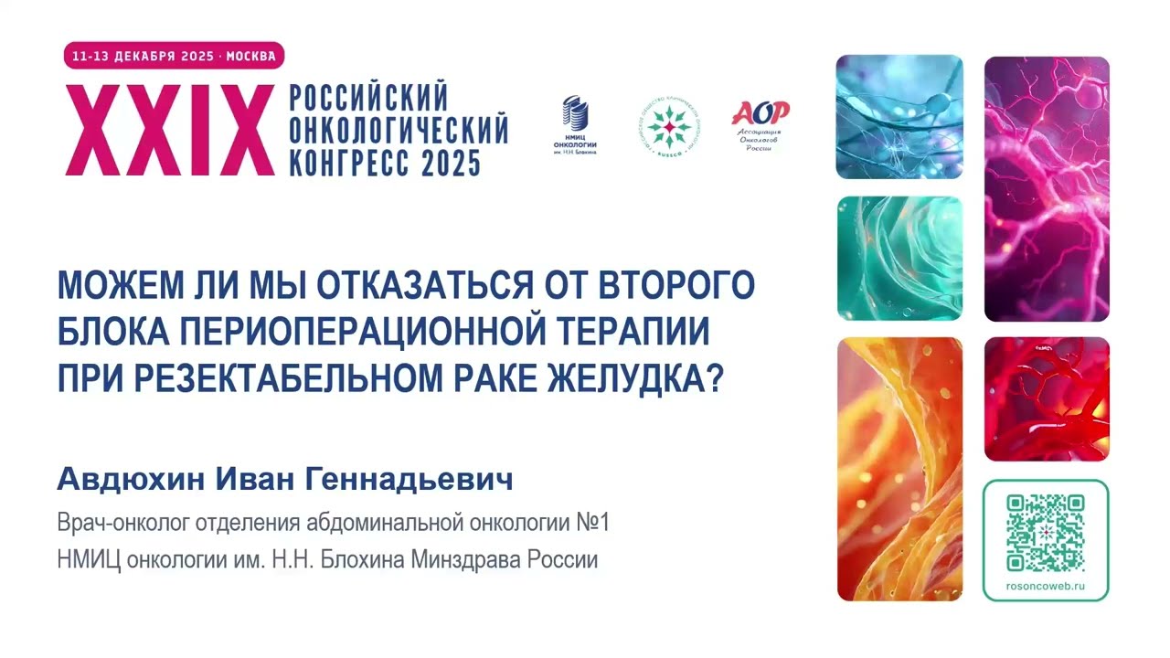 Можем ли мы отказаться от второго блока периоперационной терапии при резектабельном раке желудка?