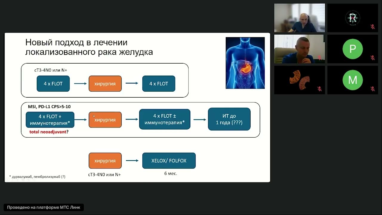 Опухоли ЖКТ (вебинар 4 марта 2026)