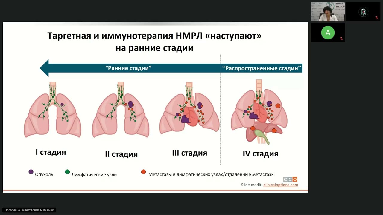 Иммуноонкология. Немелкоклеточный рак легкого (вебинар 2 марта 2026)