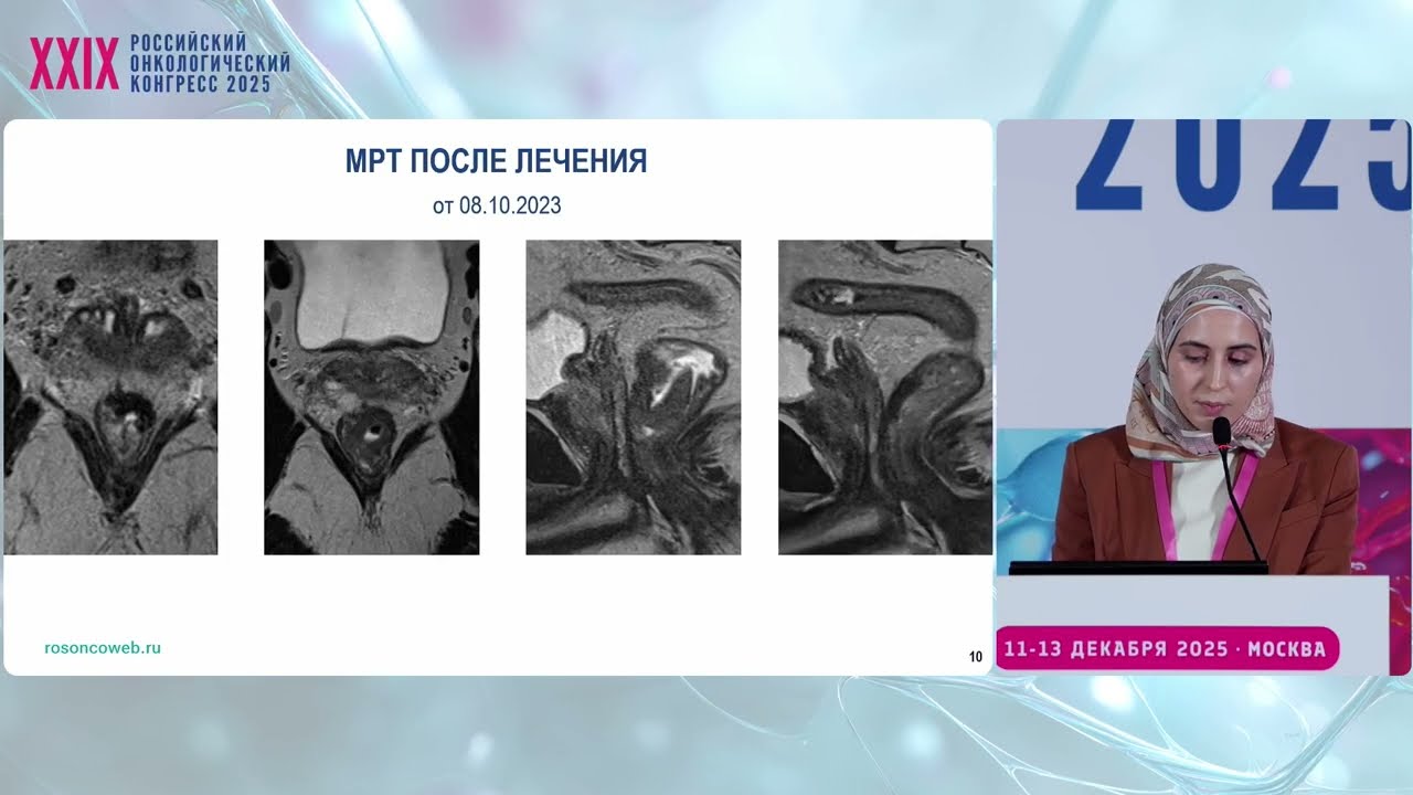 Клинический случай: Тотальная неоадъювантная терапия с целью достижения полного клинического ответа