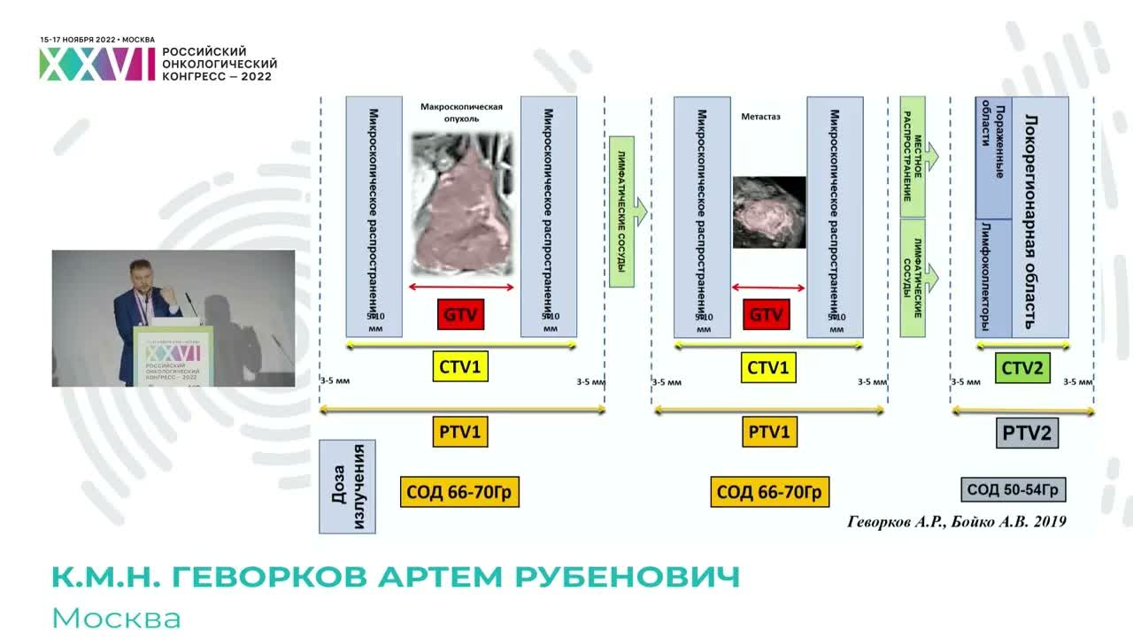 Перспективы лечения ВПЧ-ассоциированного рака ротоглотки с точки зрения радиотерапевта