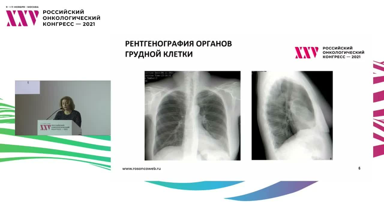 Выбор диагностических подходов при инфекциях у онкологических больных. Роль компьютерной томографии