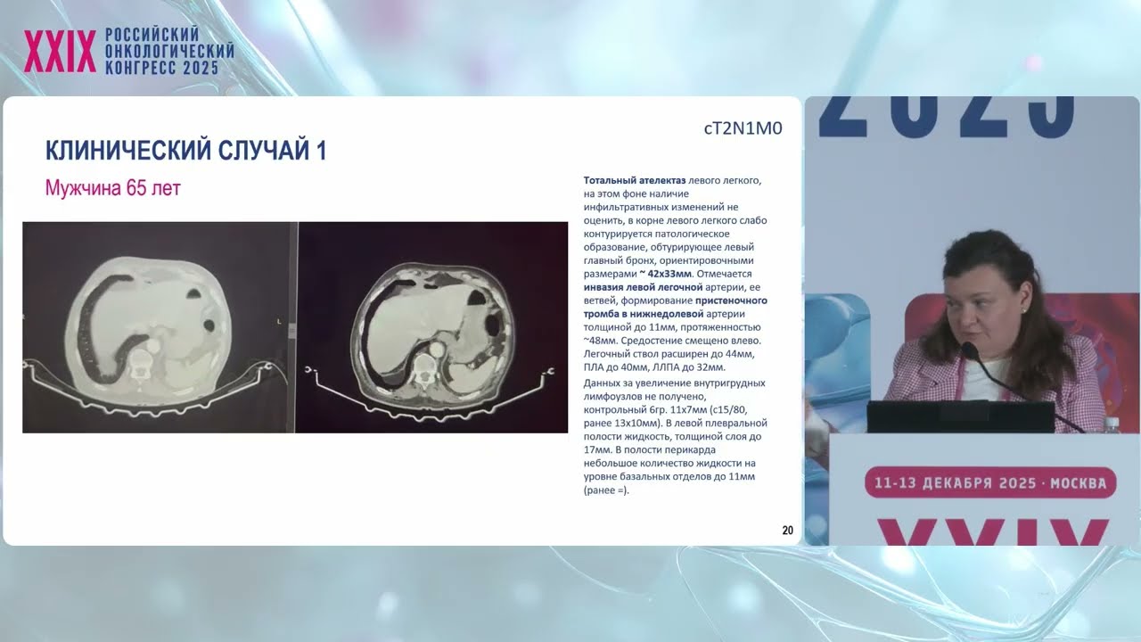 Немелкоклеточный рак легкого - Т4: взгляд химиотерапевта