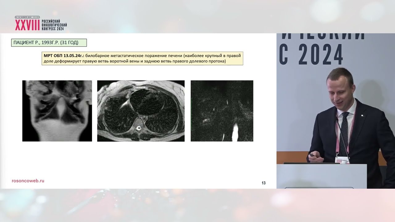 Циторедукция «вне закона». Нейроэндокринная опухоль