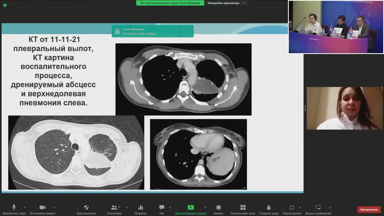 Клинический случай НМРЛ: группа с мутациями EGFR