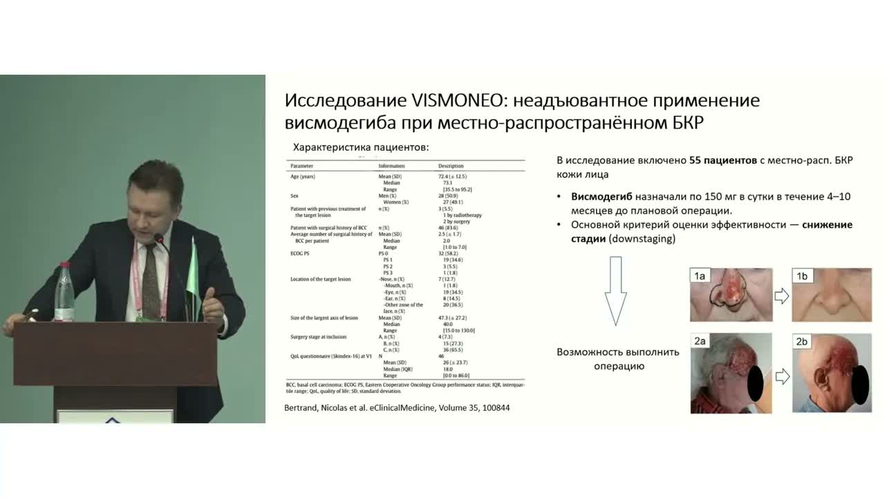 Немеланомные опухоли кожи с метастатическим потенциалом. Неоадъювантные подходы когда и кому?