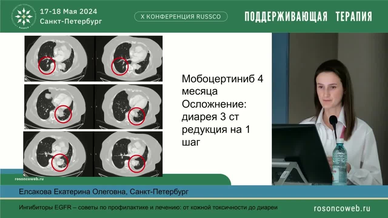 Ингибиторы EGFR – советы по профилактике и лечению: от кожной токсичности до диареи
