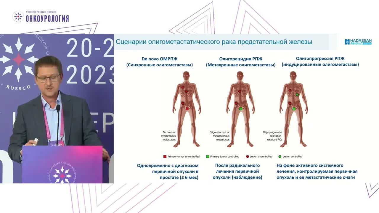 Олигометастатический рак предстательной железы: отбор пациентов для метастаз-направленной терапии