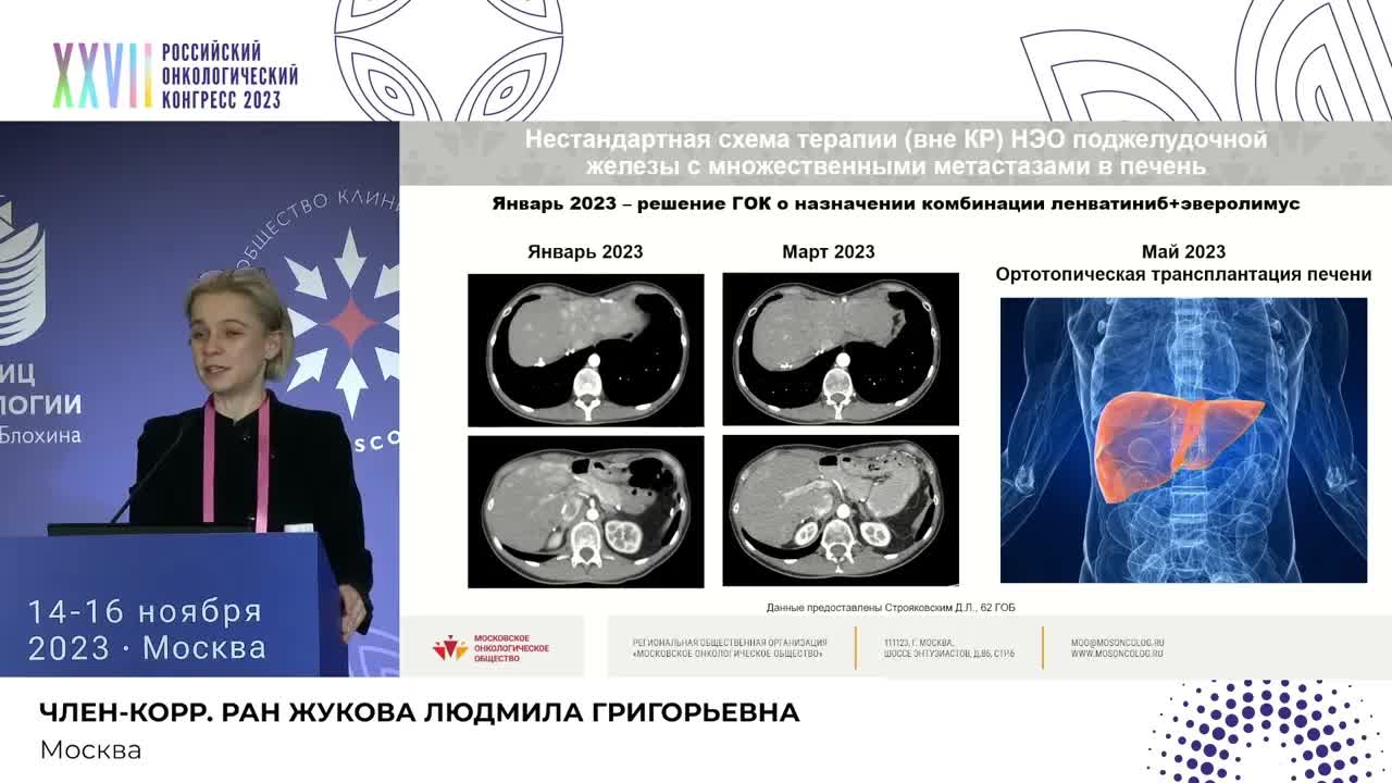 Опыт работы Городского онкологического консилиума