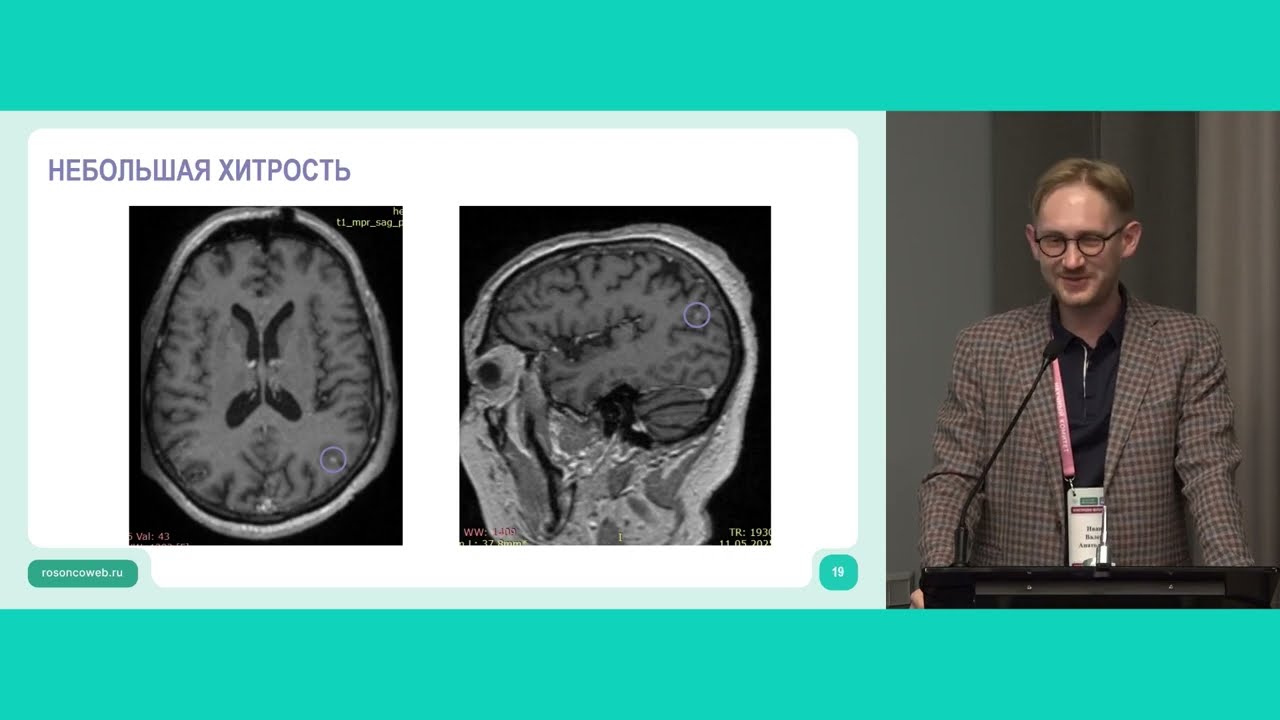 Тактика лечения по результатам тестирования. Наблюдение для лучевого терапевта