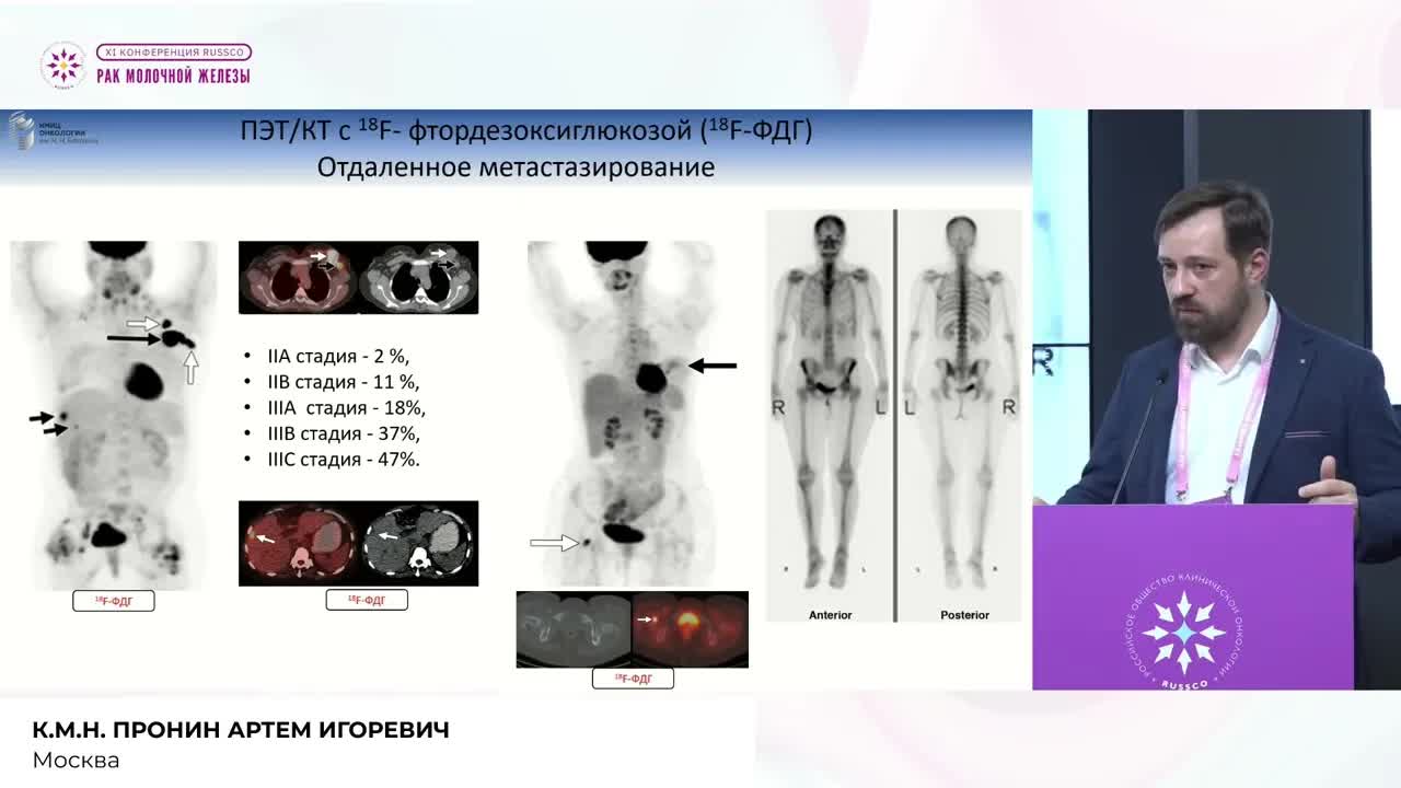 Оценка динамики костных метастазов РМЖ по ПЭТ-КТ
