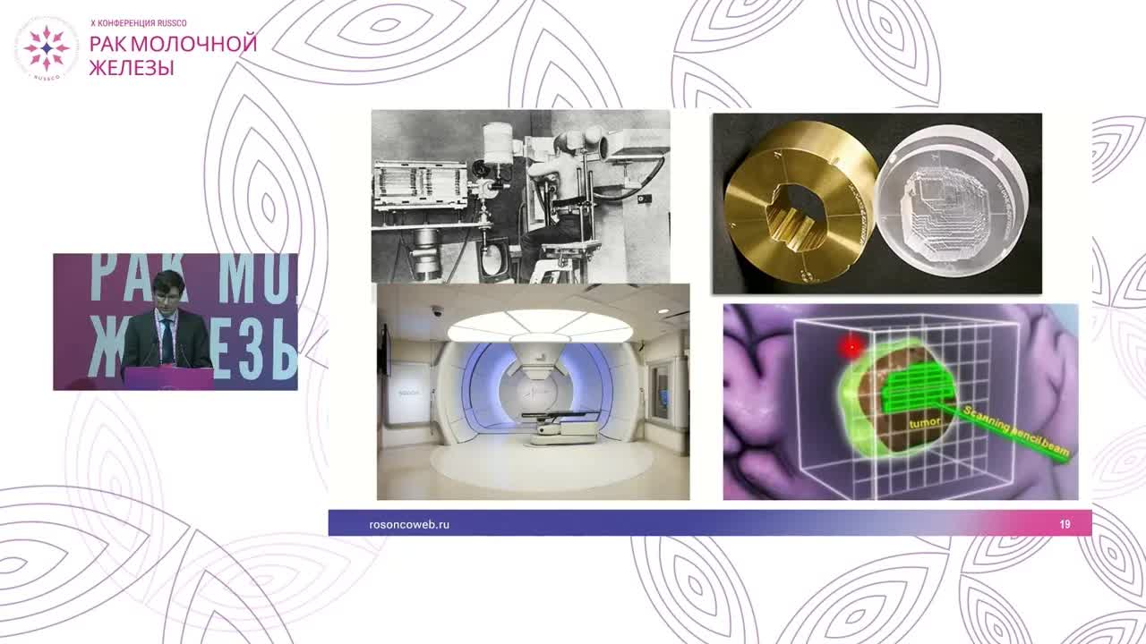 Современные технологии лучевой терапии при раке молочной железы: IMRT, Vmat, протоны