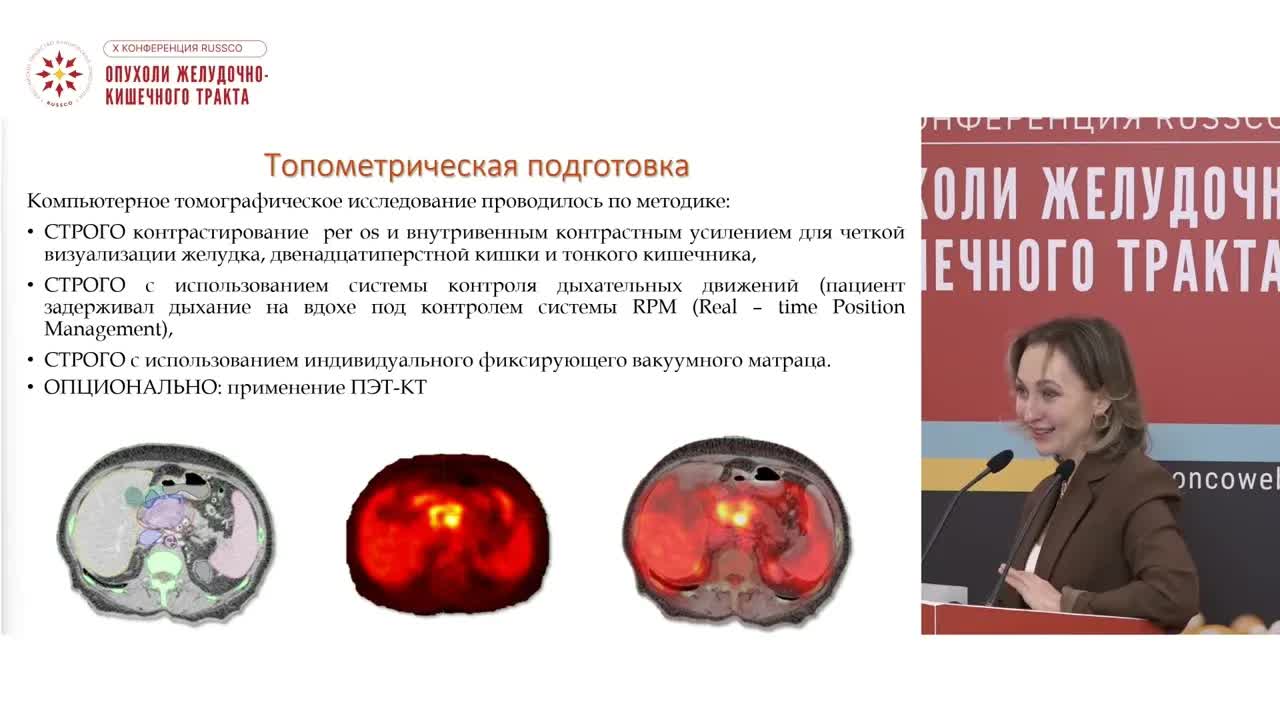 Достижения лучевой терапии при раке поджелудочной железы: от стереотаксиса до брахитерапии