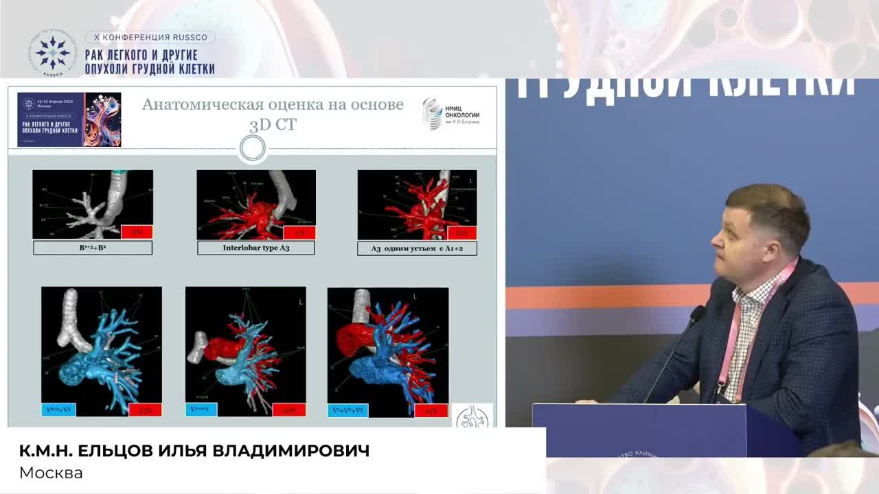 Роботассистированные зональные резекции с использованием ICG