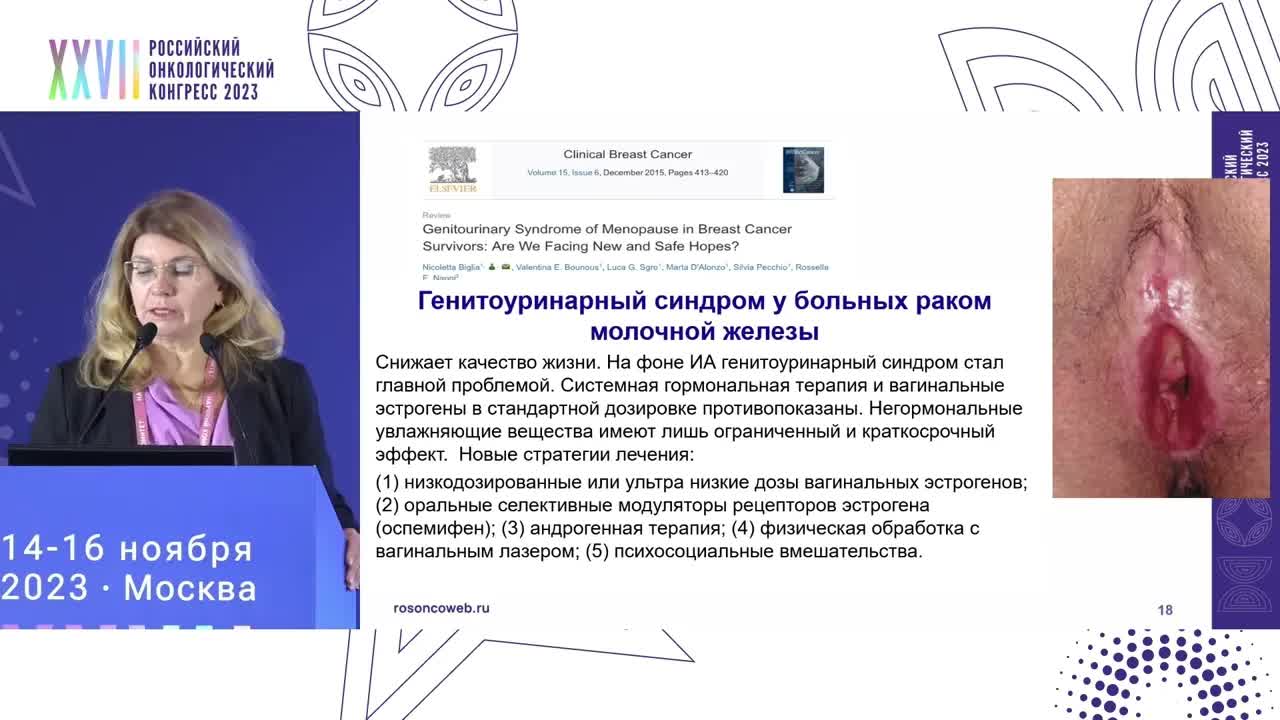 Современные возможности и перспективы лечения менопаузальных симптомов у больных HR+/HER2- РМЖ