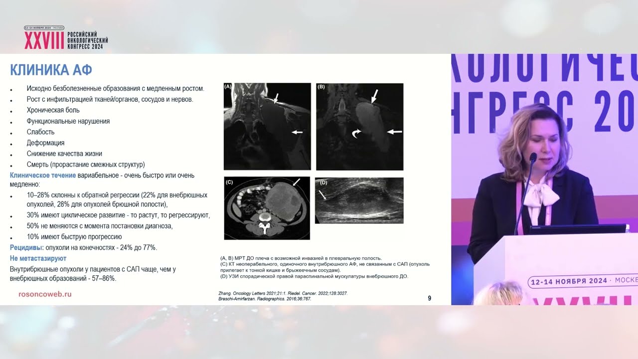 Агрессивный фиброматоз