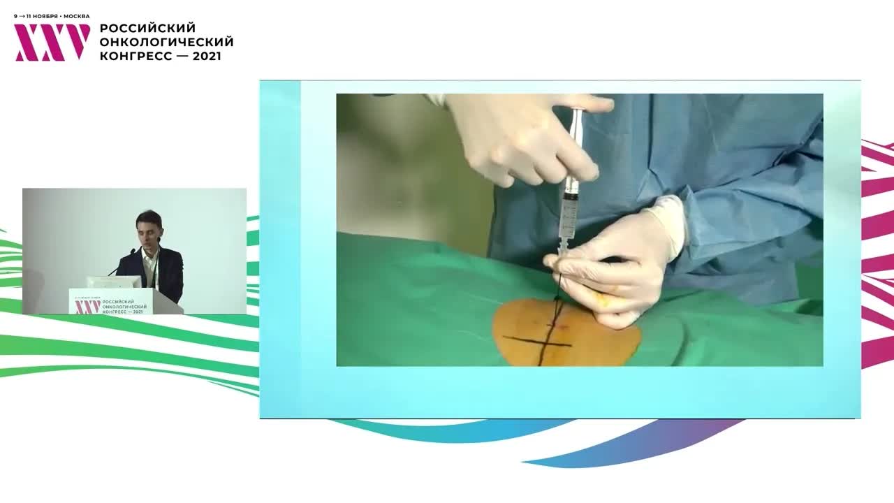 Радиочастотная селективная абляция в лечении болевого синдрома у онкологических пациентов