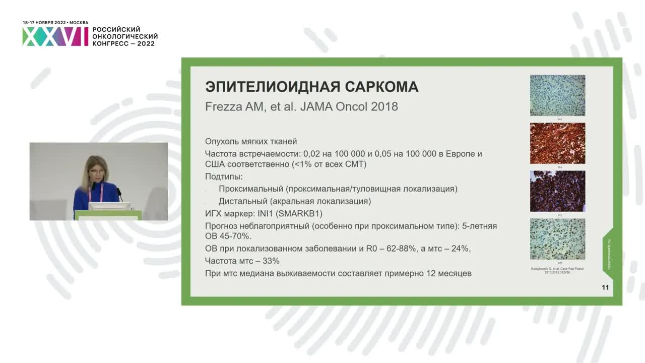 Лекарственное лечение редких подтипов сарком