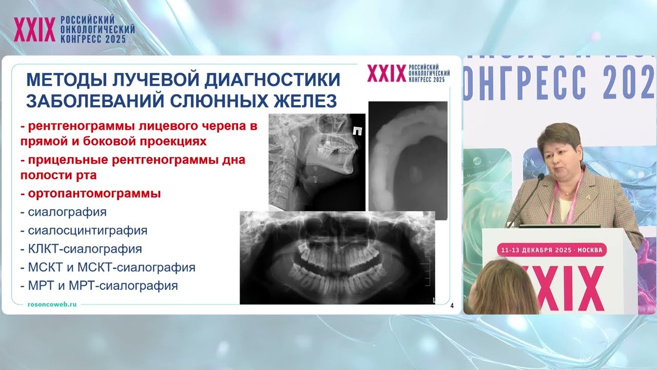 ЗНО слюнных желез. Как найти темную кошку в черной комнате: слово специалистам лучевой диагностики