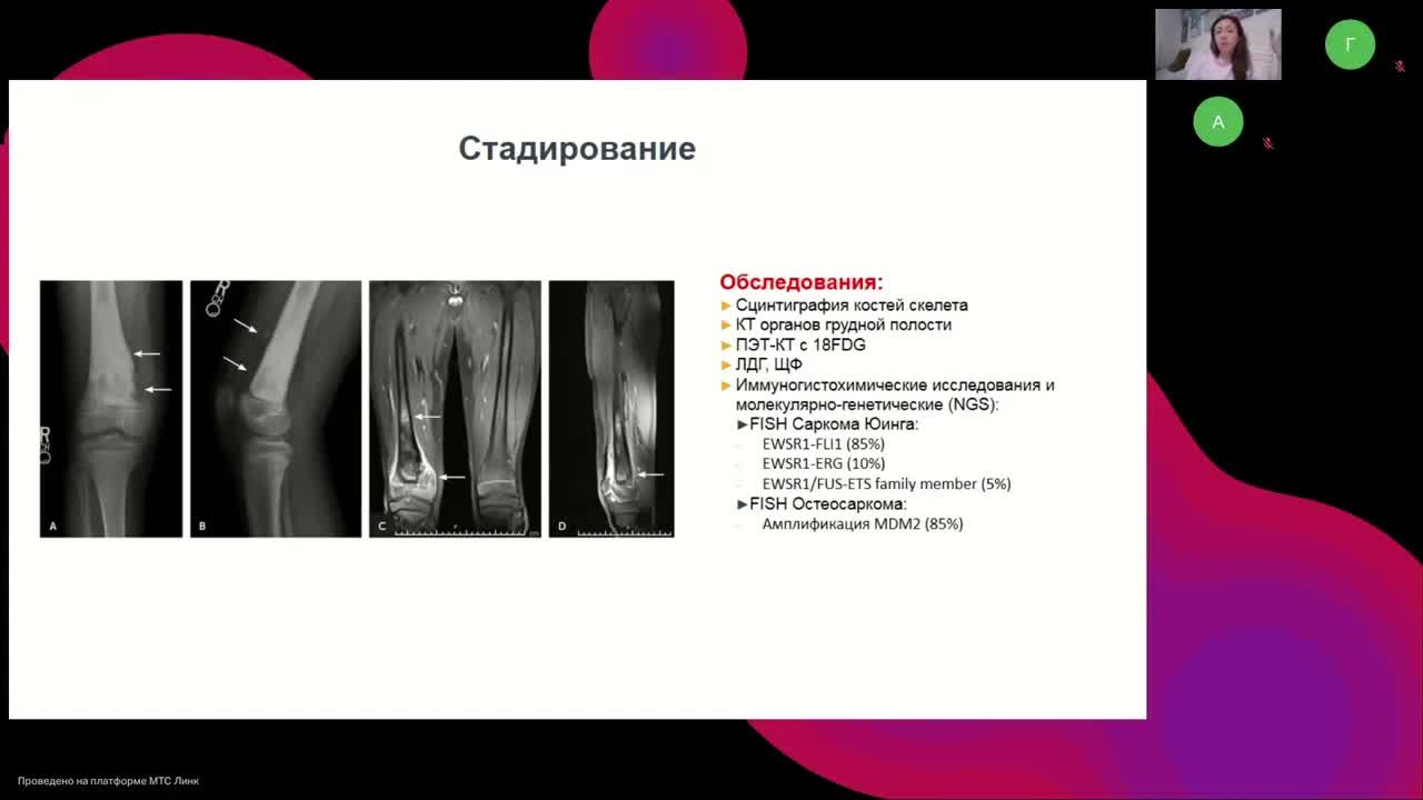  Подготовка к экзамену ESMO. Саркомы, ГИСО (вебинар 17 августа 2024)