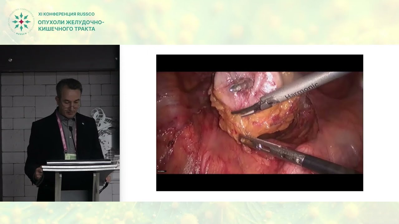 Можно ли избавиться от «ушек» при формировании колоректального анастомоза?