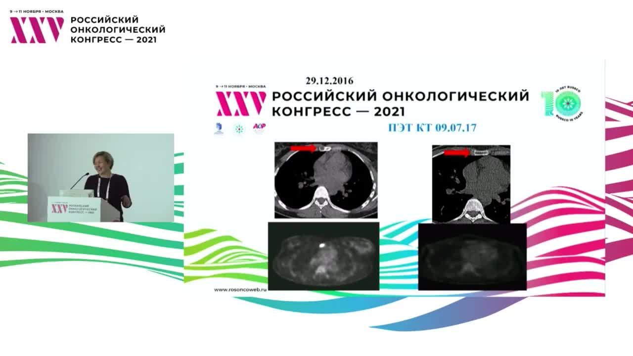 Когда наступает время хирургического лечения РМЖ при диссеминированном процессе? 