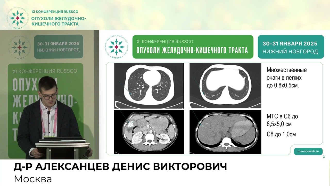 Роль циторедуктивных операций при неоперабельном метастатическом раке толстой кишки