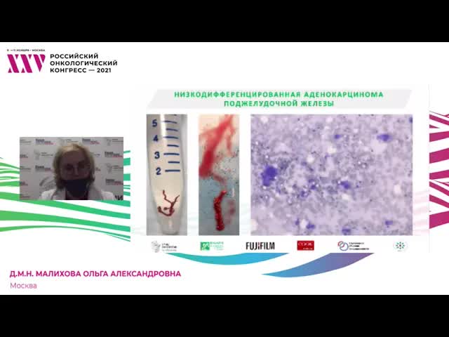 Мастер-класс «Роль мультимодального подхода в лечении неметастатического рака поджелудочной железы»