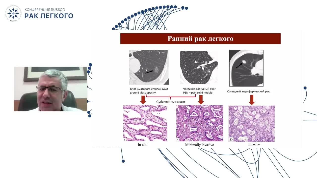 Как принять правильное решение об операбельности местнораспространенного рака легкого в рамках МДК?