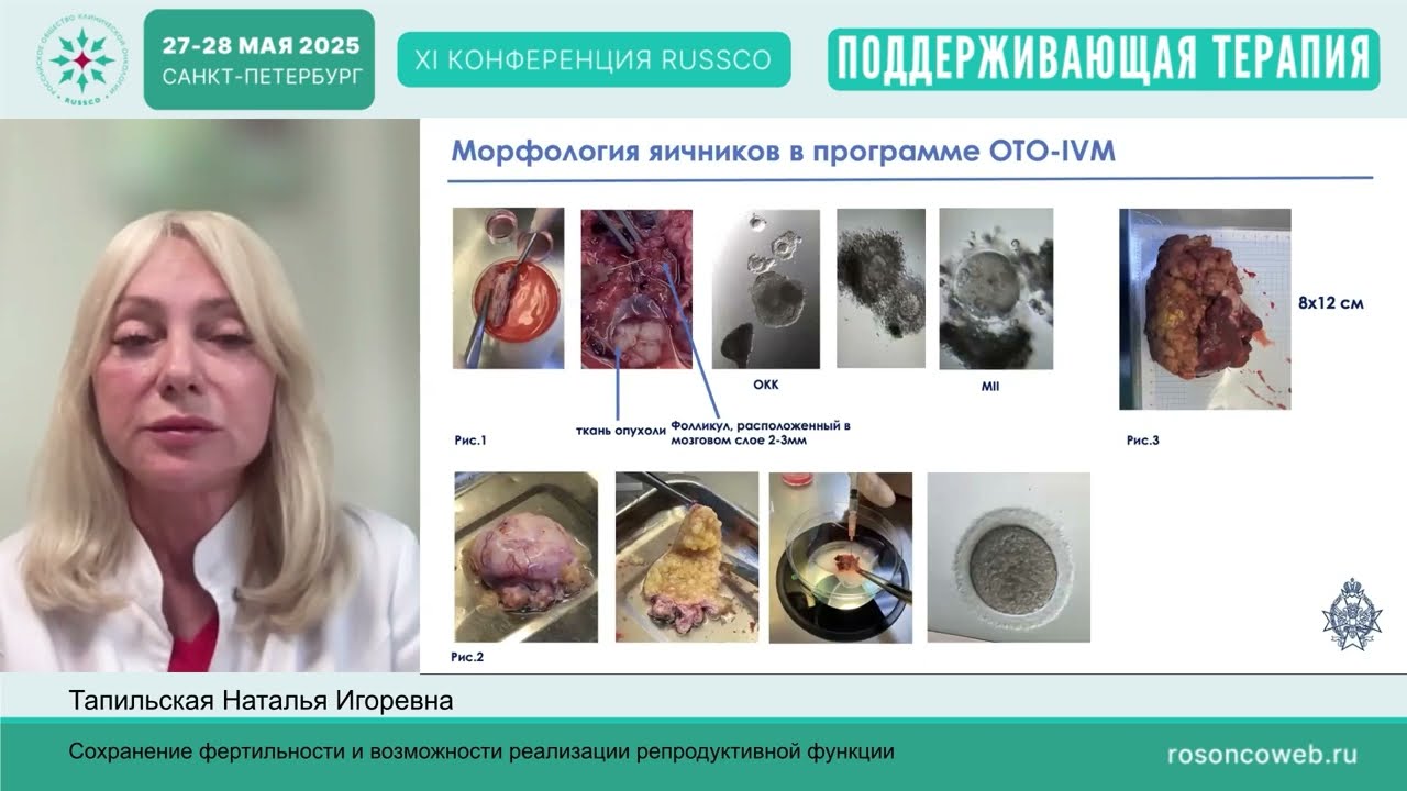 Сохранение фертильности и возможности реализации репродуктивной функции