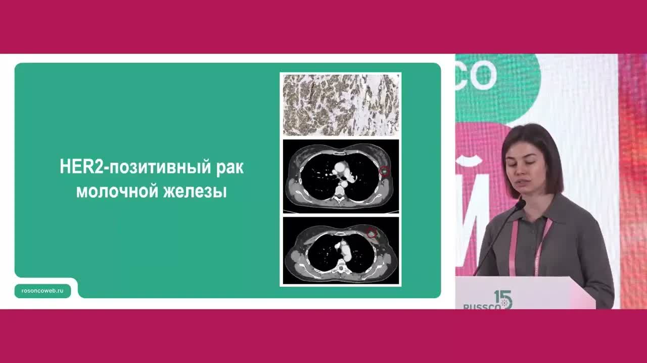 Отказ от препаратов платины в неоадъювантной терапии раннего РМЖ – совершенно недопустим