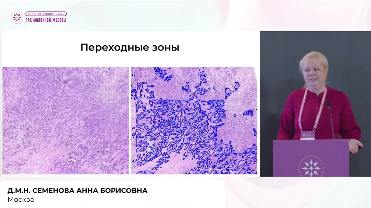 ИИ в патоморфологии: что нового нам предстоит использовать в работе уже сегодня
