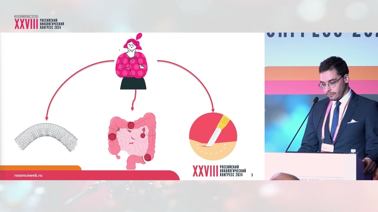 Стенозирующие опухоли ободочной кишки: стент, стома или хирургия upfront?