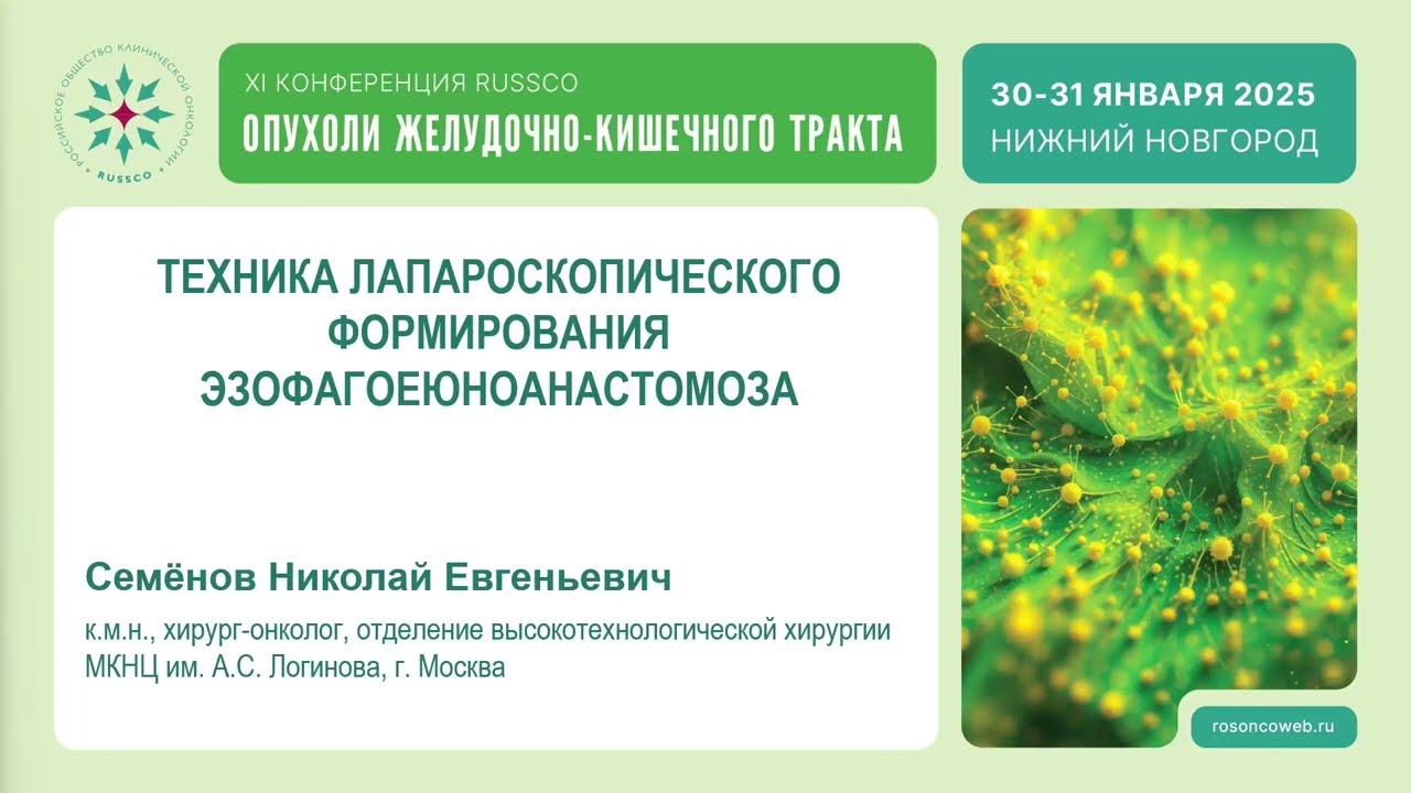 Аспекты формирования аппаратного эзофагоеюноанастомоза при лапароскопической гастрэктомии