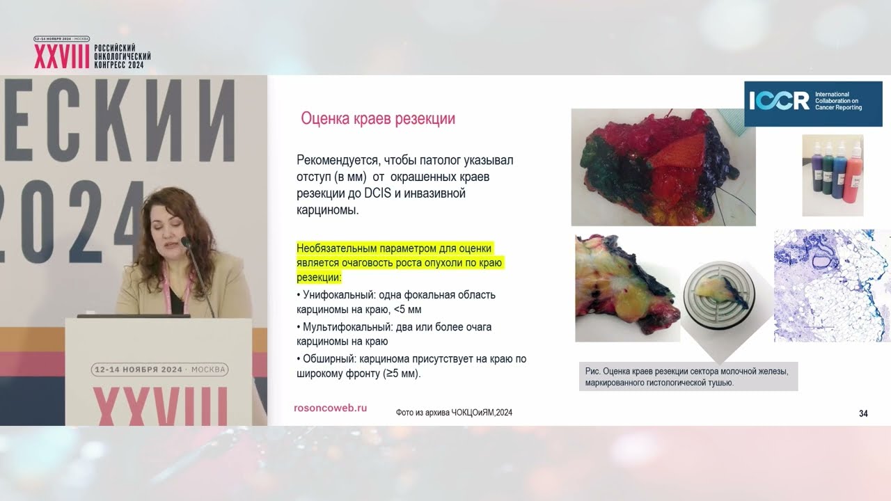 Постнеоадъювантное лечение раннего РМЖ. Морфологическая оценка ответа на НАЛТ