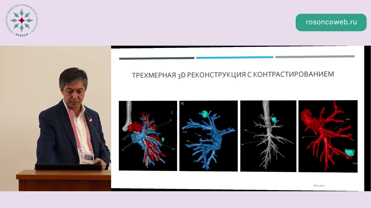 Показания к операции и ее объемы при метастазах саркомы в легких