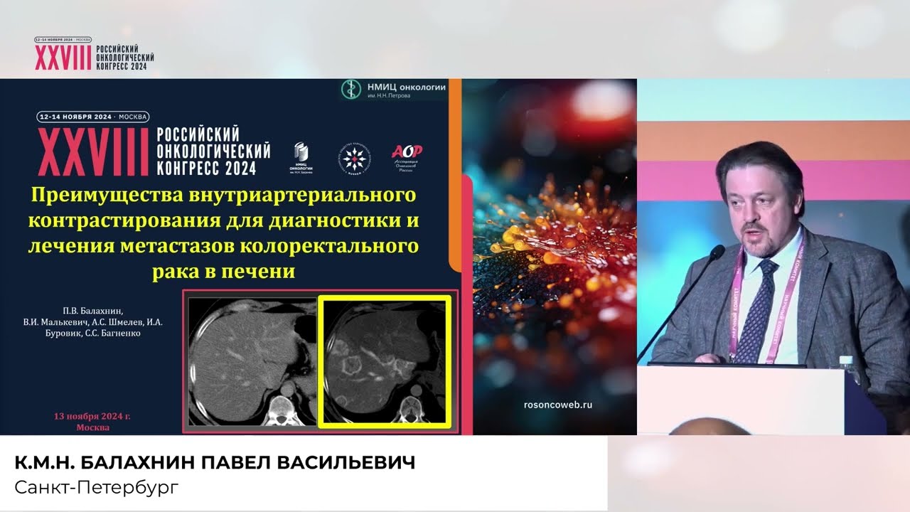 Преимущества внутриартериального контрастирования для диагностики и лечения метастазов КР в печень