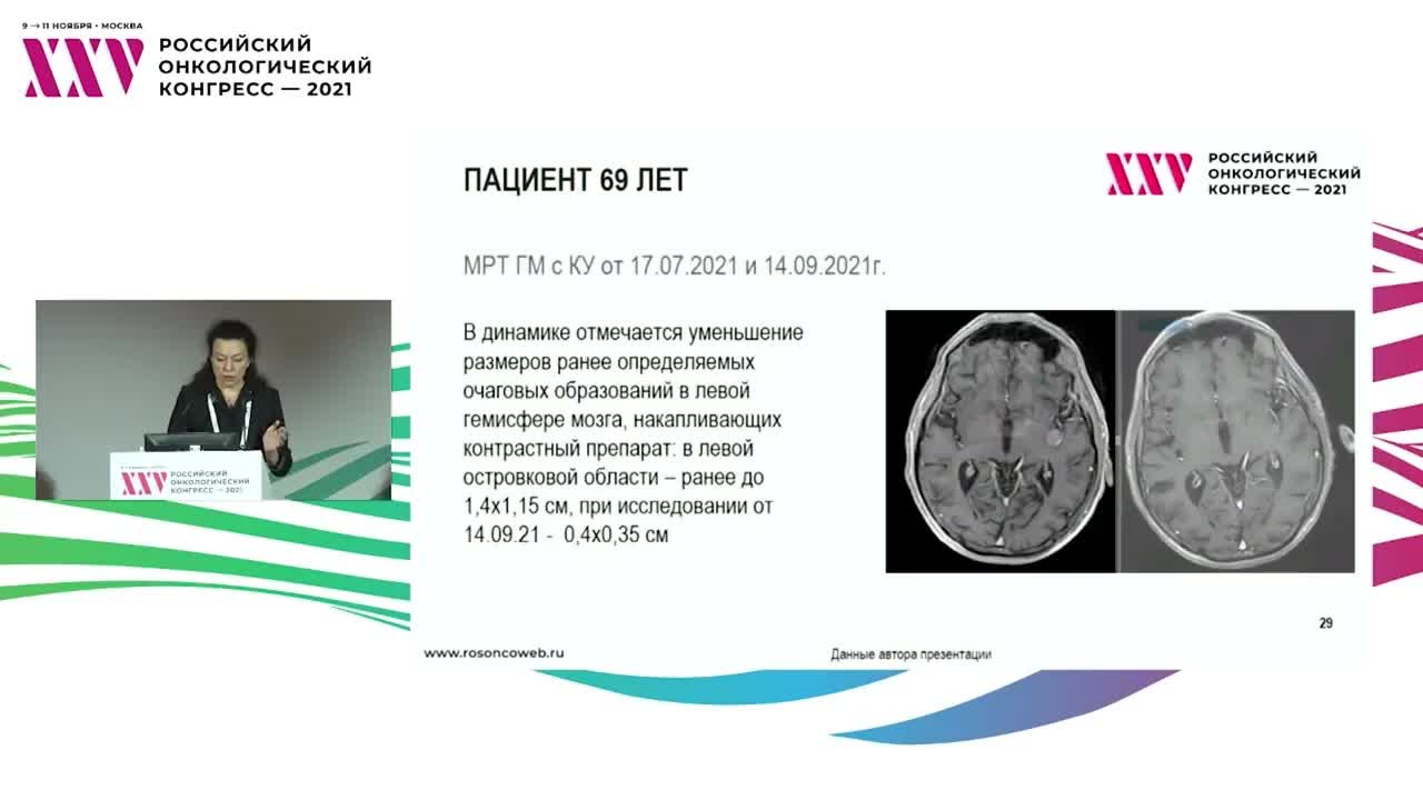 Как я лечу нейроэндокринные мелкоклеточные карциномы внелегочных локализаций