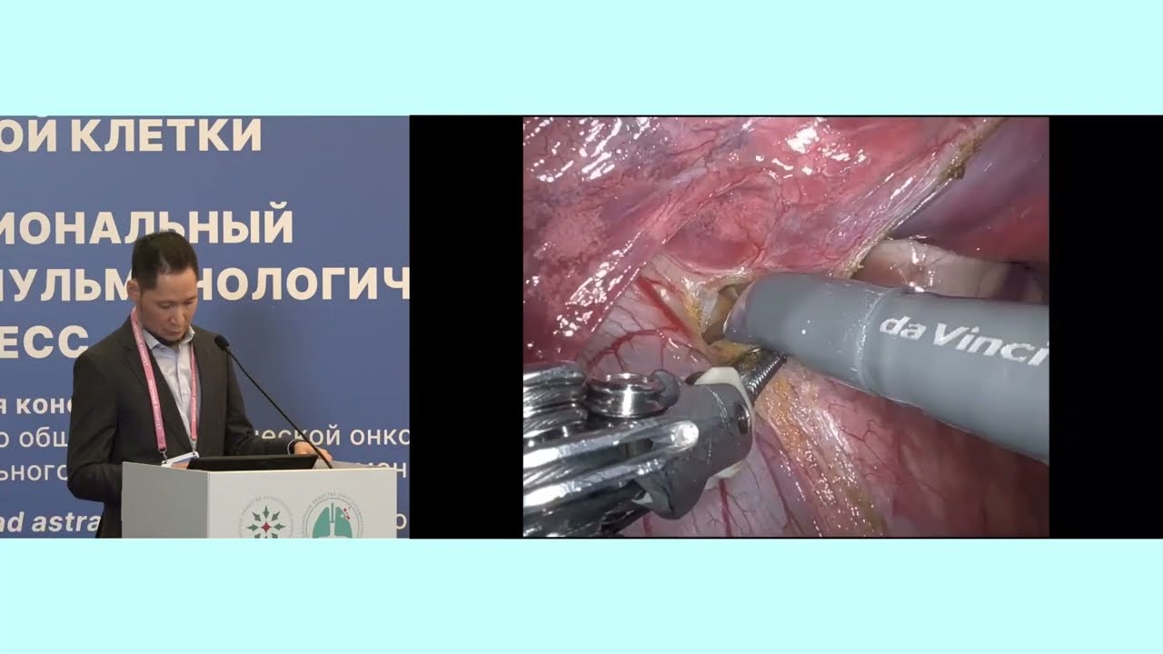 «Простые» сегментэктомии: Ибраев М.А.