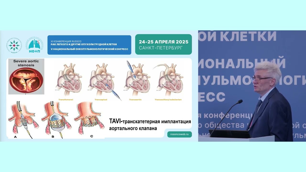 Современные подходы в хирургическом лечении больных с опухолями внутригрудной локализации