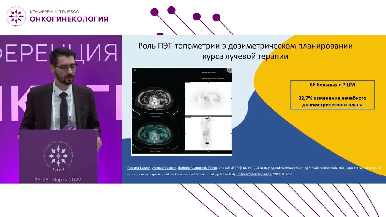 Показания к лучевой терапии при нестандартных ситуациях: рак шейки матки и поражение парааортальных лимфоузлов