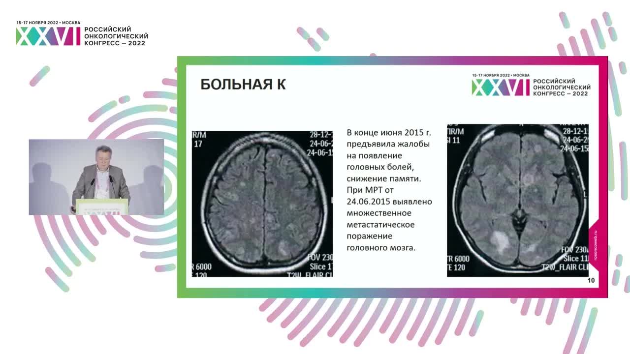Лечение пациентов с EGFR/ALK/PD-1 позитивным НМРЛ с метастазами в головном мозге
