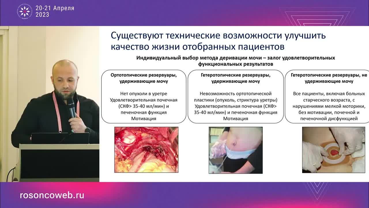 Цистэктомия – краеугольный камень успеха!