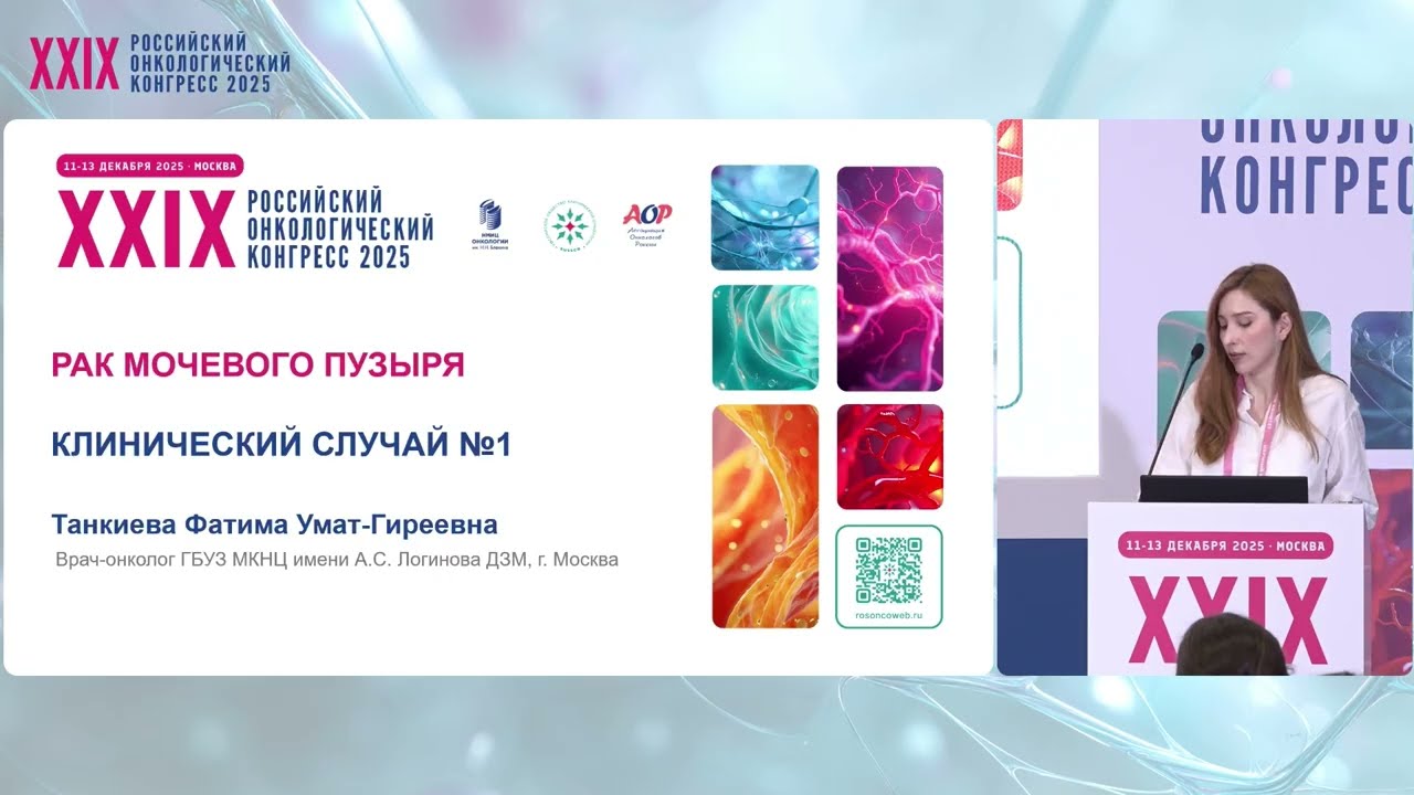 Рак мочевого пузыря. Клинический случай №1
