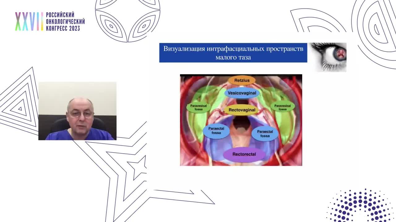 Интрафасциальные пространства в хирургии малого таза