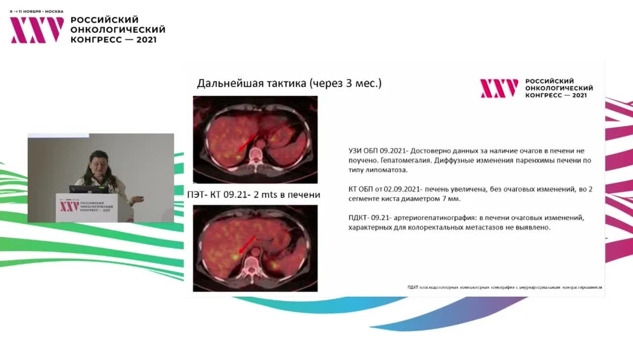 Особенности выбора терапии колоректального рака при микросателлитной нестабильности