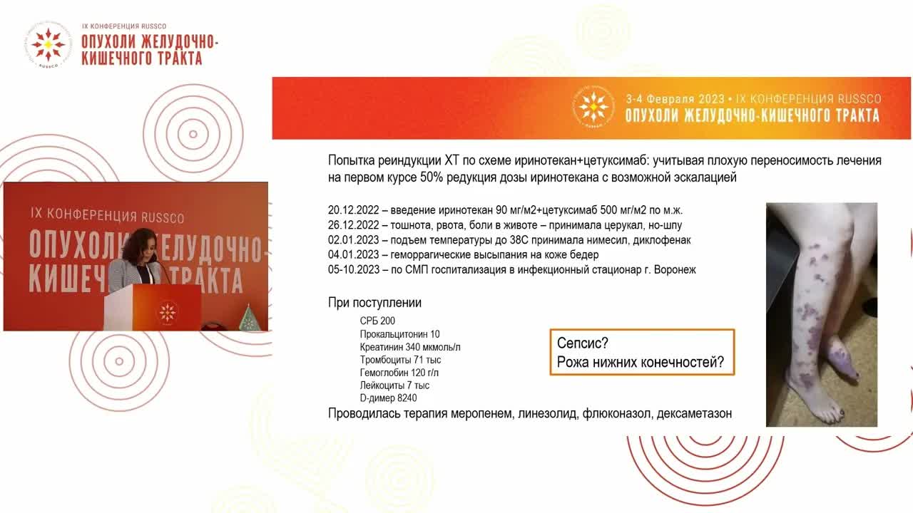 Разбор клинических наблюдений: плоскоклеточный рак анального канала