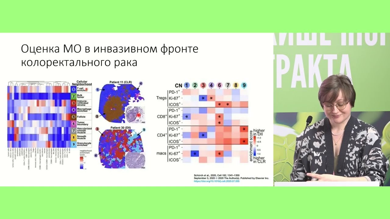 Влияние микроокружения опухоли на прогноз и эффективность лечения. Мнение морфолога