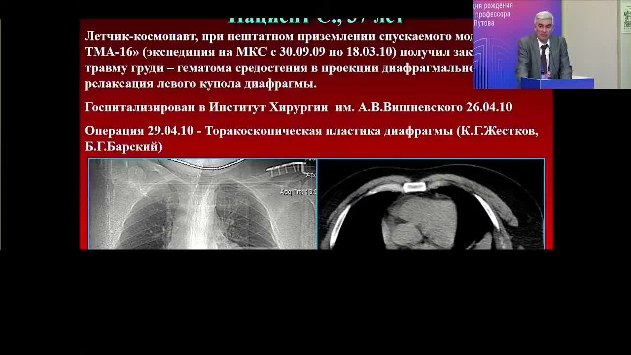Хирургия заболеваний и повреждений диафрагмы
